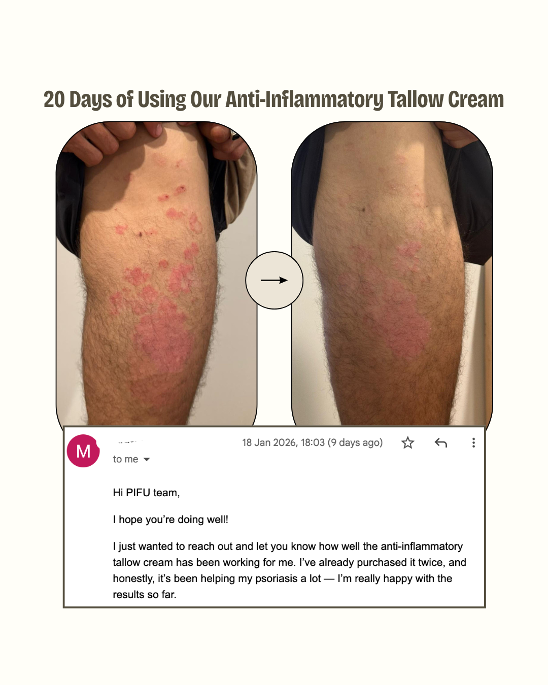 Honey Tallow Cream Moisturiser | Our Anti-inflammatory Blend