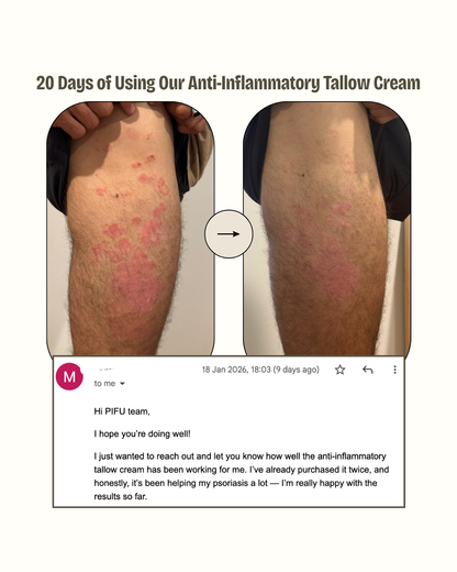 Honey Tallow Cream Moisturiser | Our Anti-inflammatory Blend