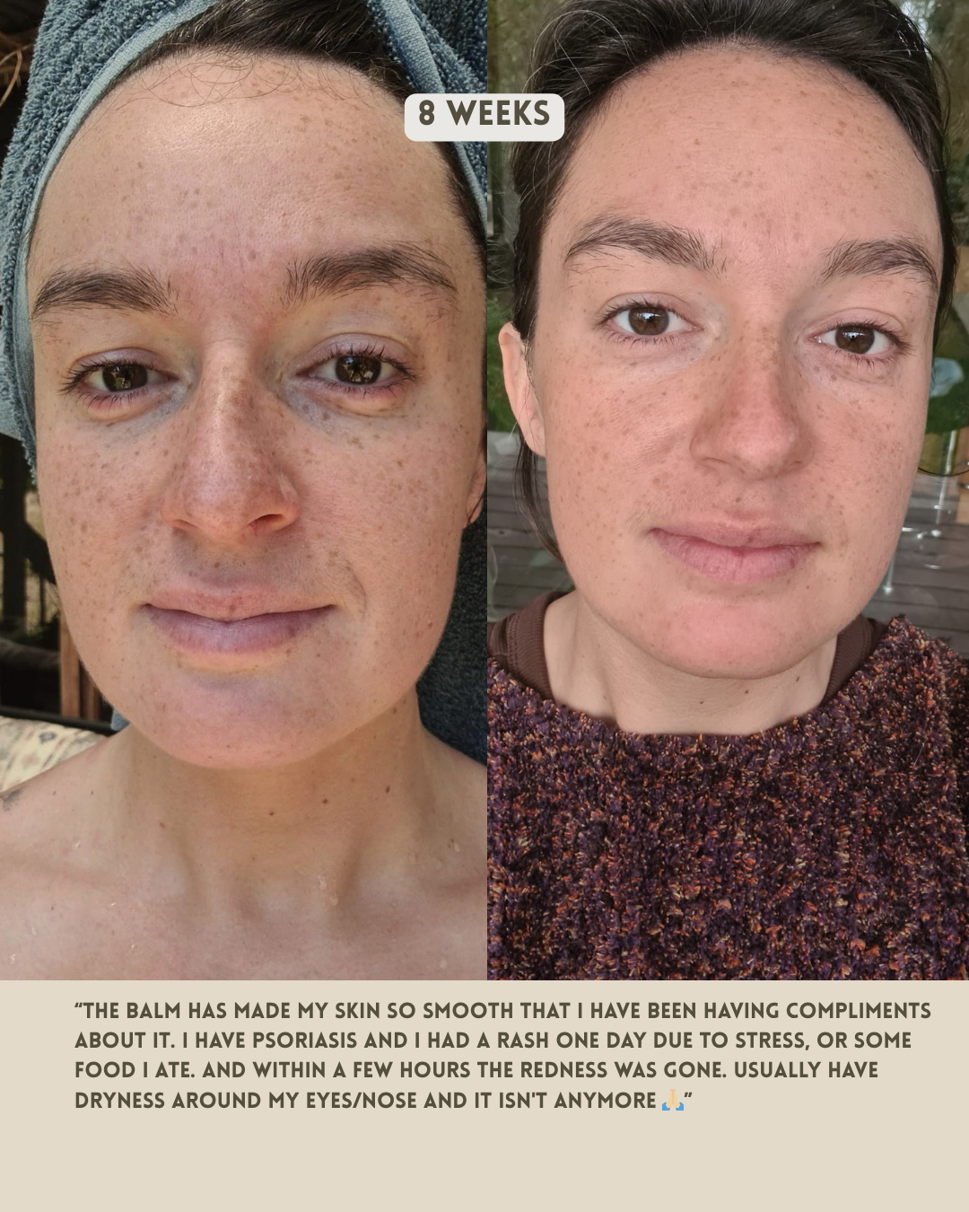 Tallow Bakuchiol Golden Balm - Natural Retinol Alternative